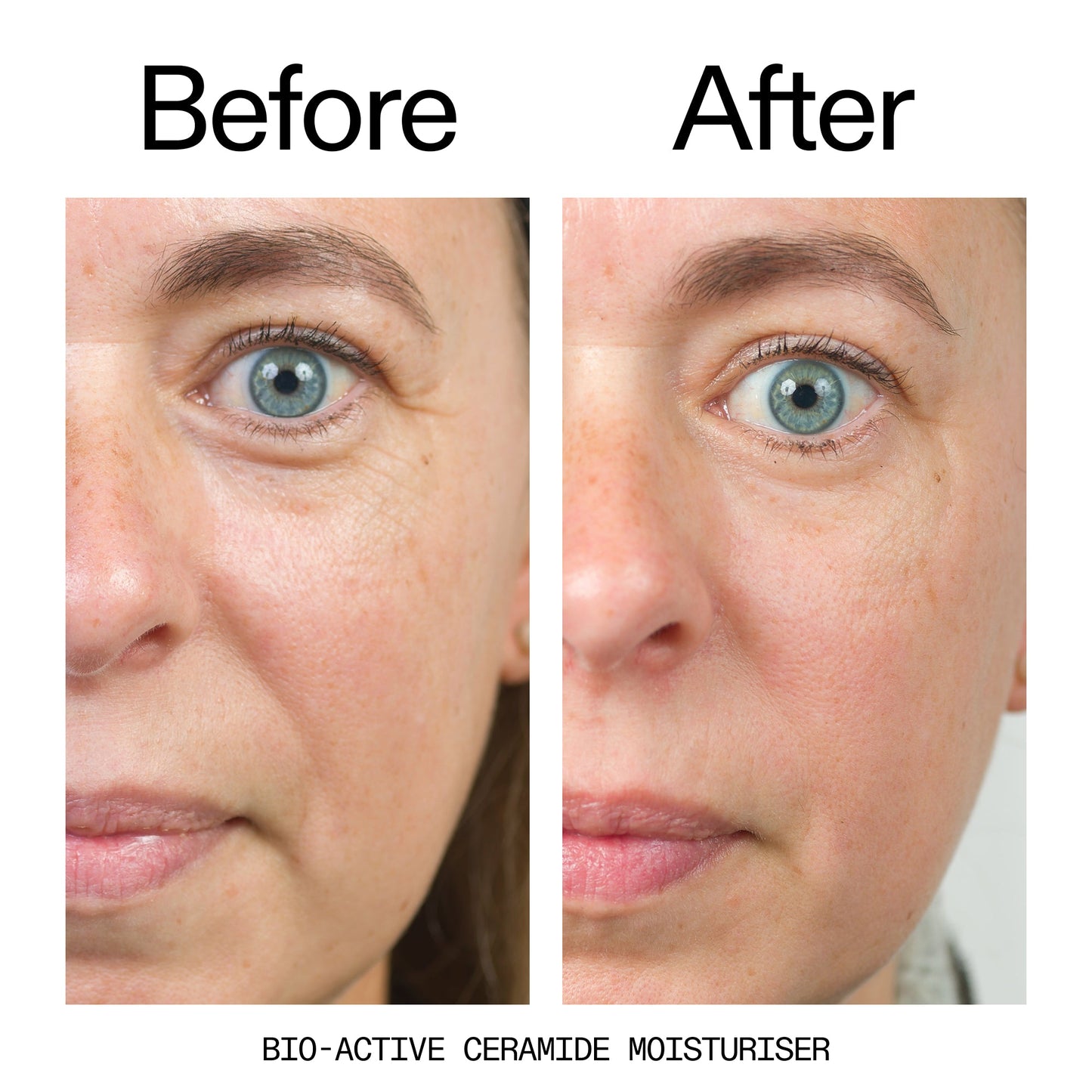 barrier-boosting-trio-t2 Bio-Active_Before_After_2000x2000_600947b4-e8c5-425a-9155-fc15bc83aa12.jpg
