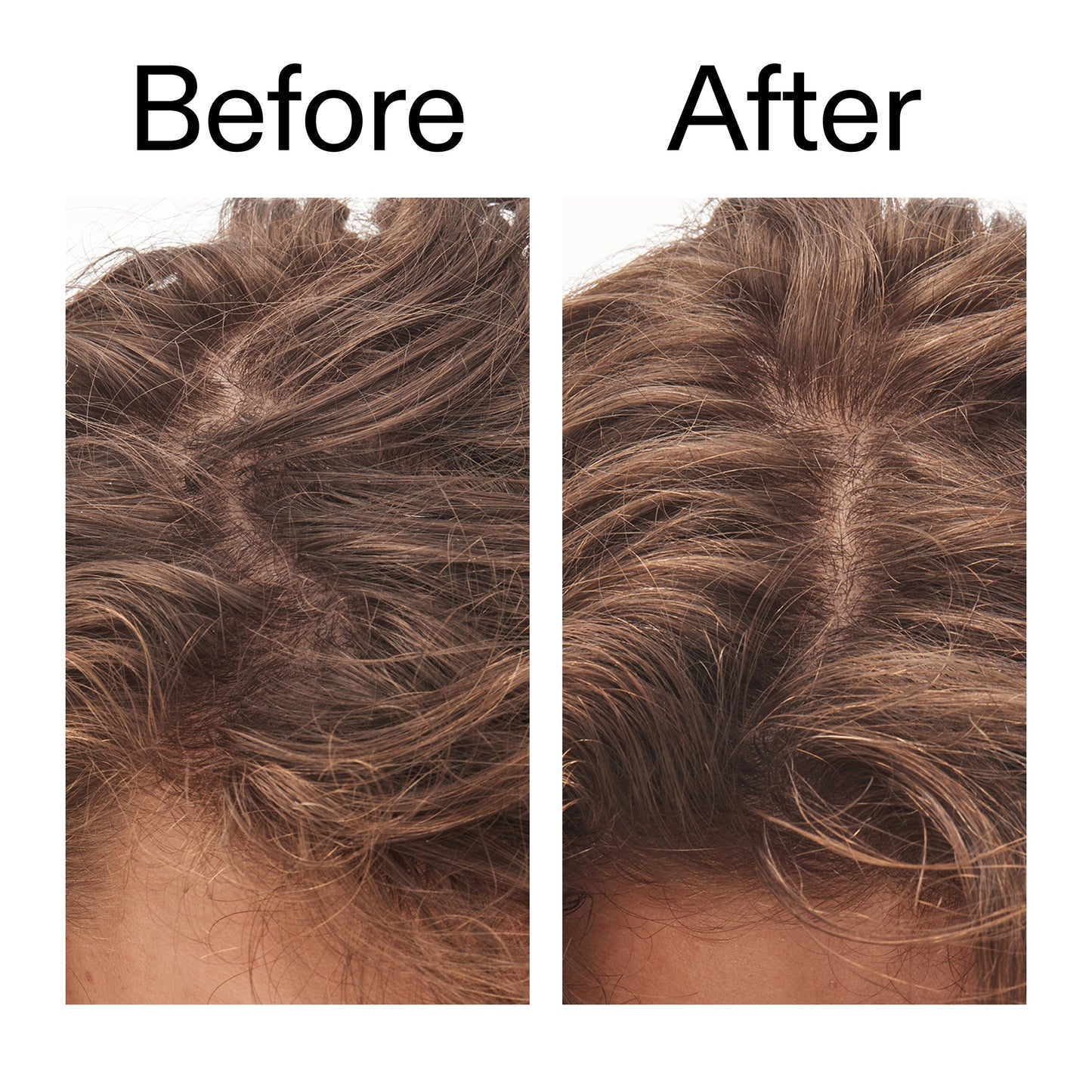 glycolic-acid-exfoliating-scalp-scrub-b5 Glycolic_Acid_Exfoliating_Scalp_Scrub_Before_After_2000x2000_b8561c87-05a1-4caa-80f7-1b6b33d750f7.jpg