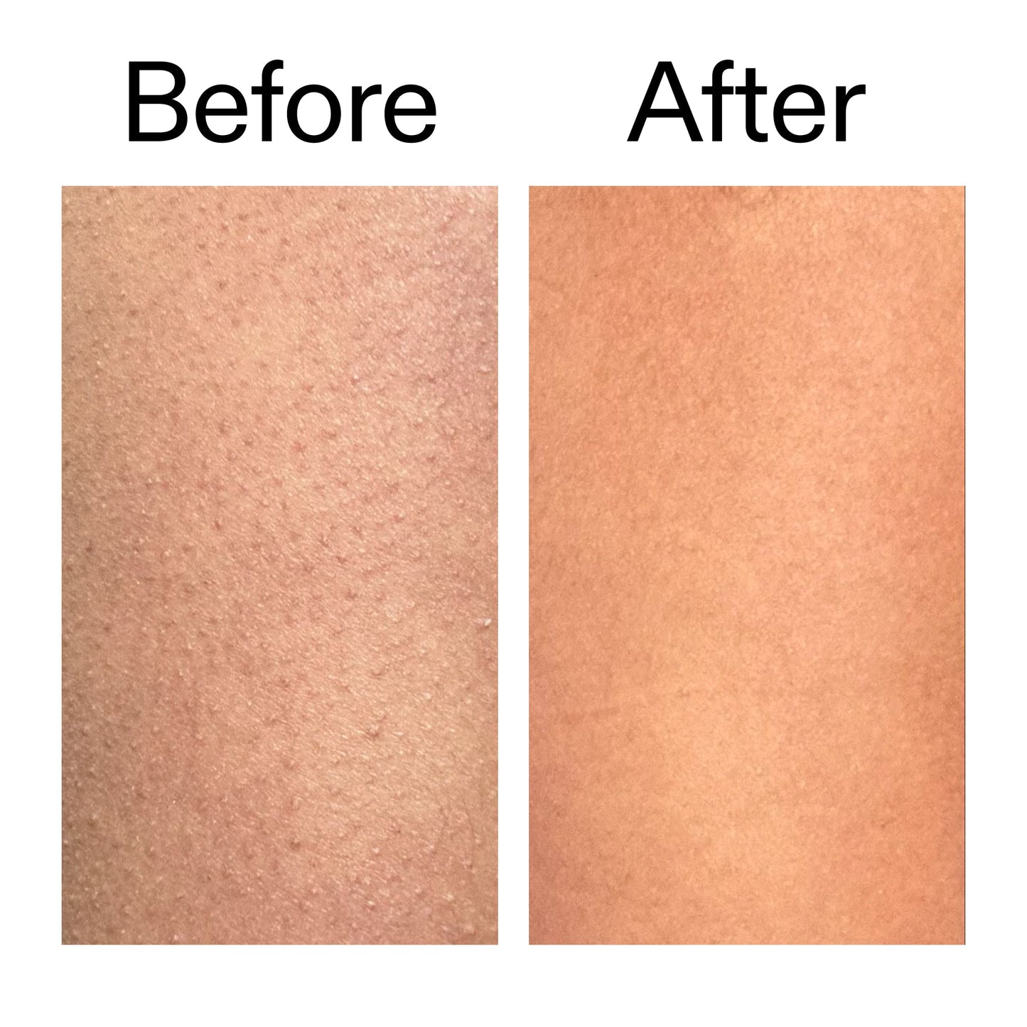 glycolic-acid-exfoliating-body-stick-duo-t8 Glycolic_Body_Stick_B_A_2000x2000_6e6e6b4d-5bd7-43c0-aeed-4d66788e8995.jpg