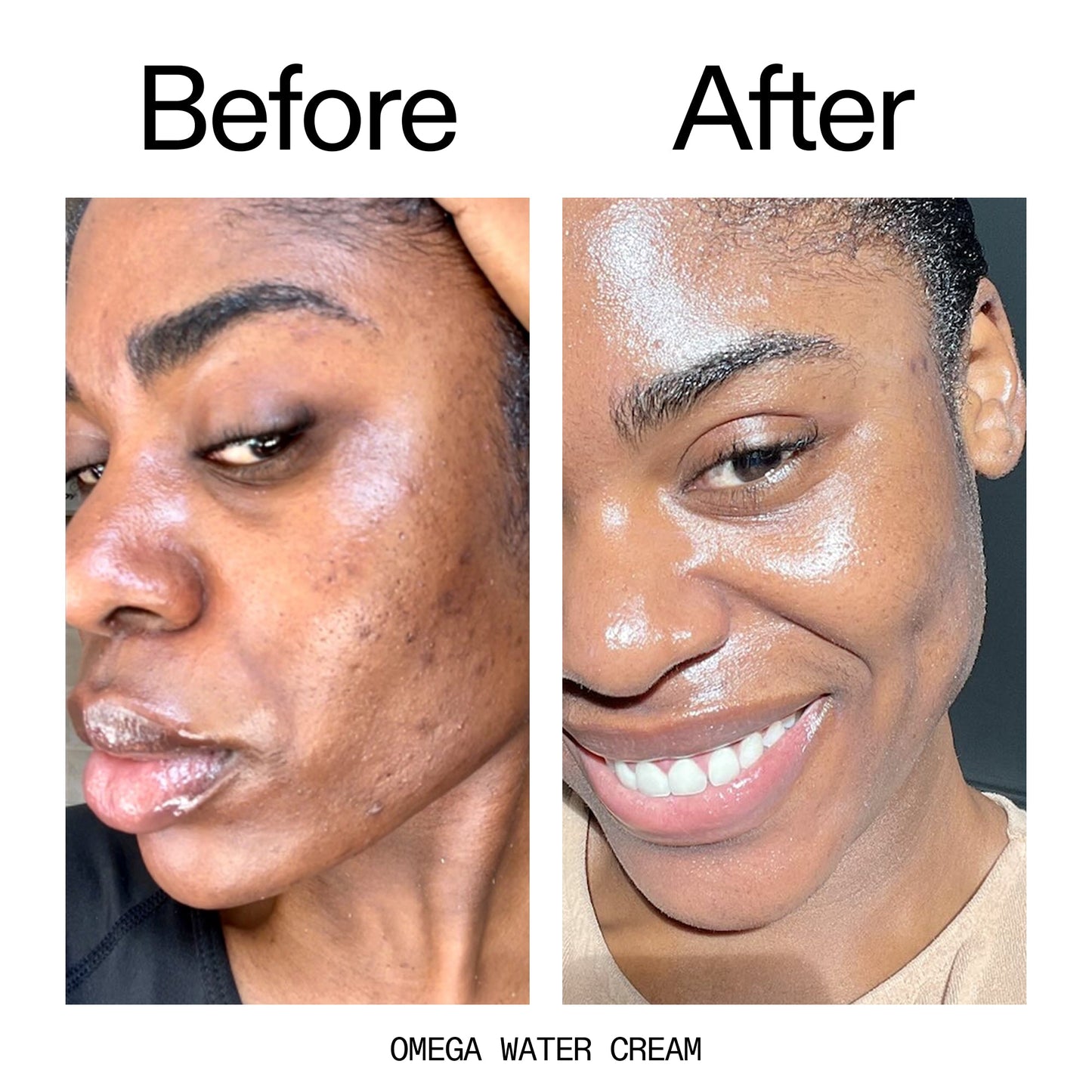 glowing-skin-set-b4 Omega_Water_Cream_Before_After_2000x2000_8e88278b-8c8d-48dc-ac77-4e98ebbd1b77.jpg