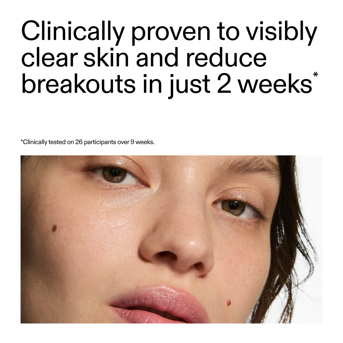 360-acne-clearing-duo-o2 360_Serum_Key_Claim.png