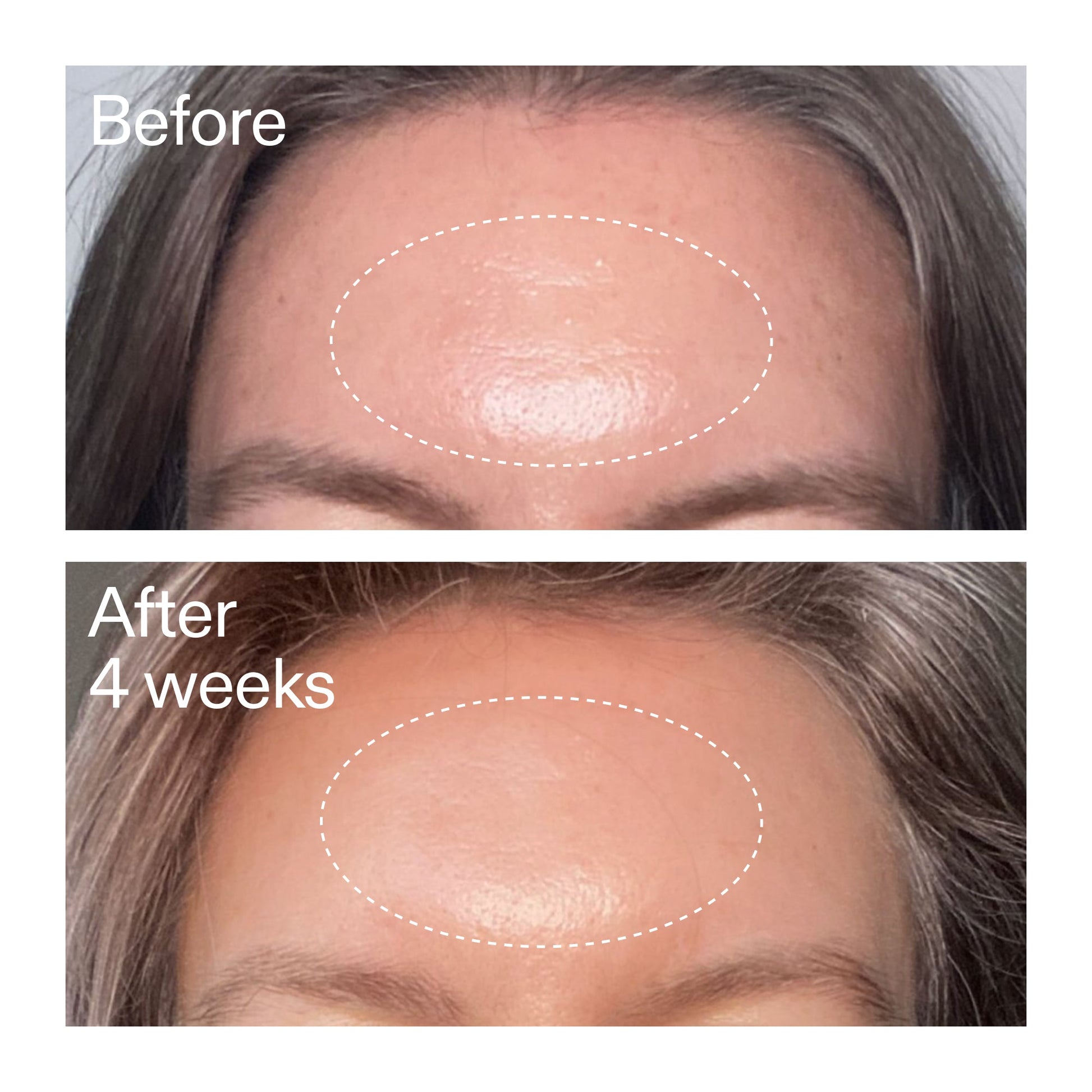 advanced-0-2-retinal-serum-duo-k4 AdvancedRetinal_BeforeAfter1_2000x2000_4e9c798a-f30e-45b8-a34a-7c4740f2f2cb.jpg