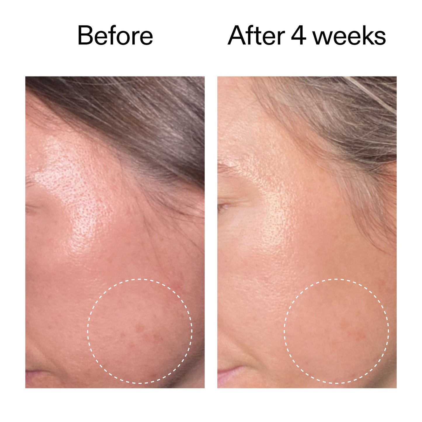 advanced-0-2-retinal-serum-duo-k4 AdvancedRetinal_BeforeAfter2__2000x2000_8ef75542-2316-4814-81ee-0f66a85912bc.jpg