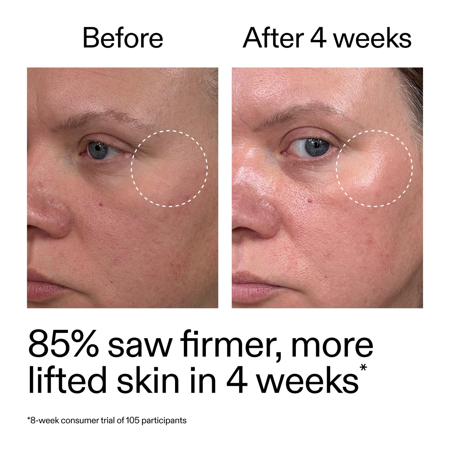 advanced-0-2-retinal-serum-duo-k4 AdvancedRetinal_BeforeAfter_Claim1_2000x2000_3a315aa8-f408-4b33-bbeb-0d9209f98404.jpg