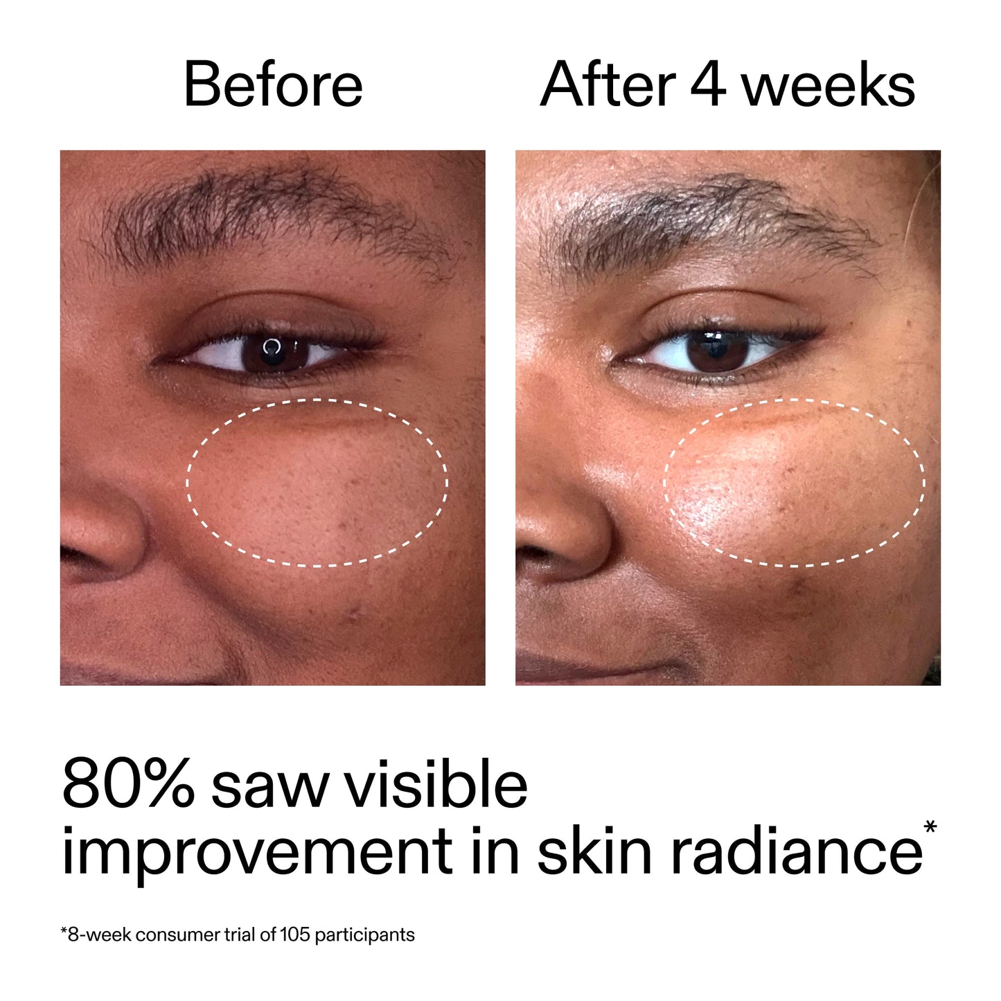 advanced-0-2-retinal-serum-s6 AdvancedRetinal_BeforeAfter_Claim2_2000x2000_39d11e3d-eda9-44ec-ab32-2903b1a368bd.jpg