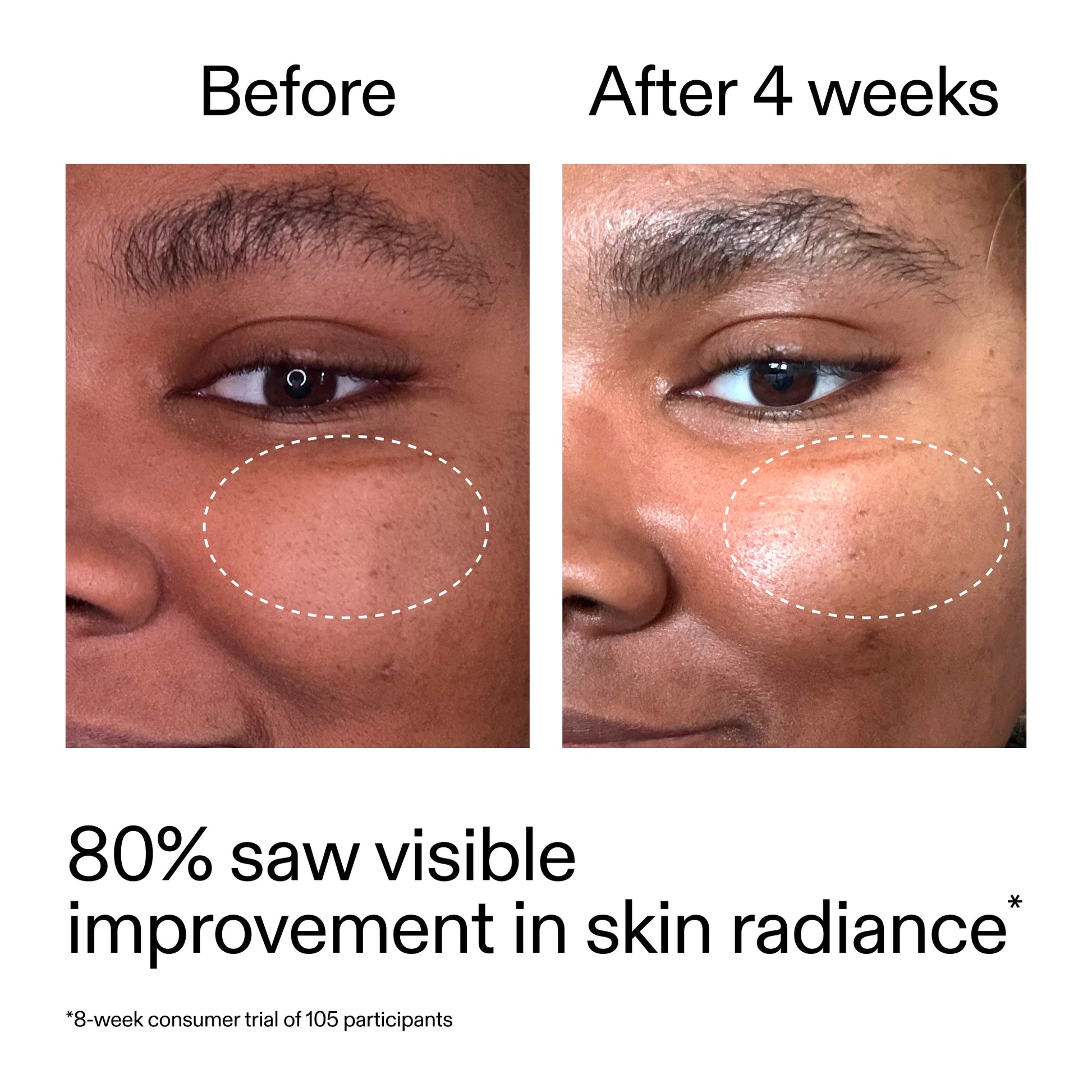 advanced-0-2-retinal-serum-s6 AdvancedRetinal_BeforeAfter_Claim2_2000x2000_39d11e3d-eda9-44ec-ab32-2903b1a368bd.jpg