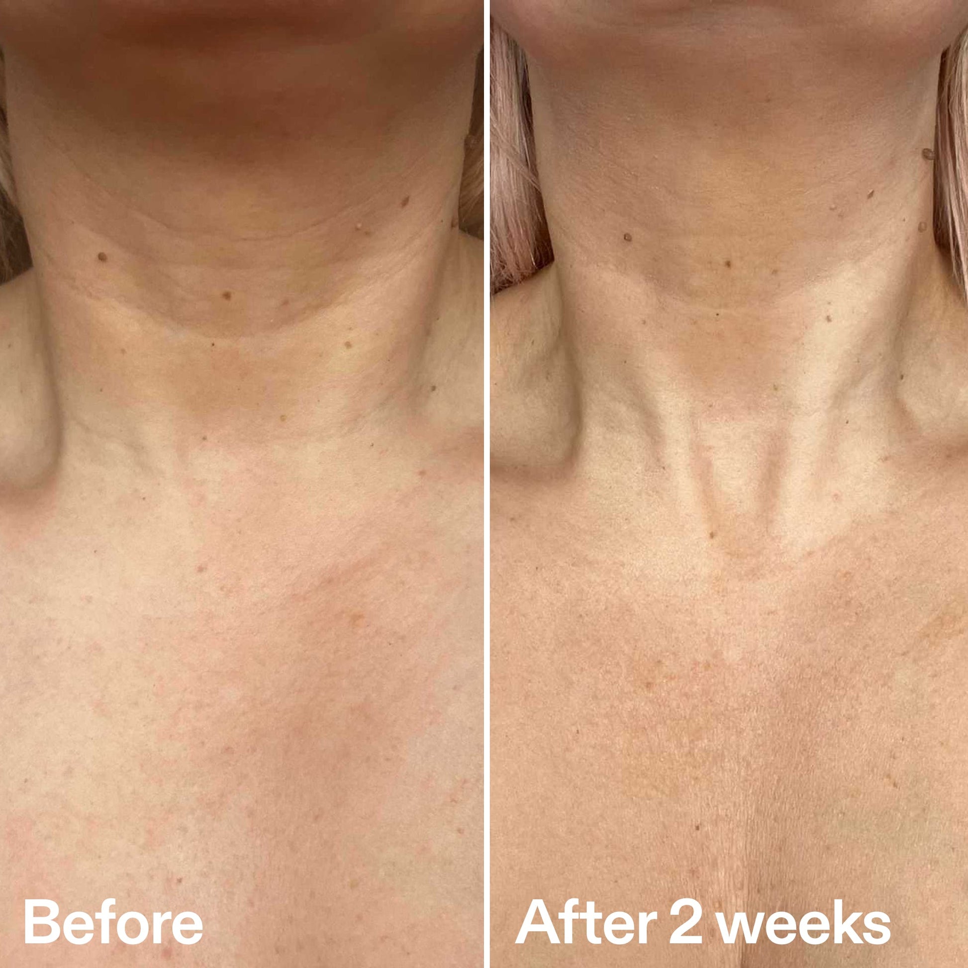 bio-active-neck-lift-stick-g7 B_A_2.jpg