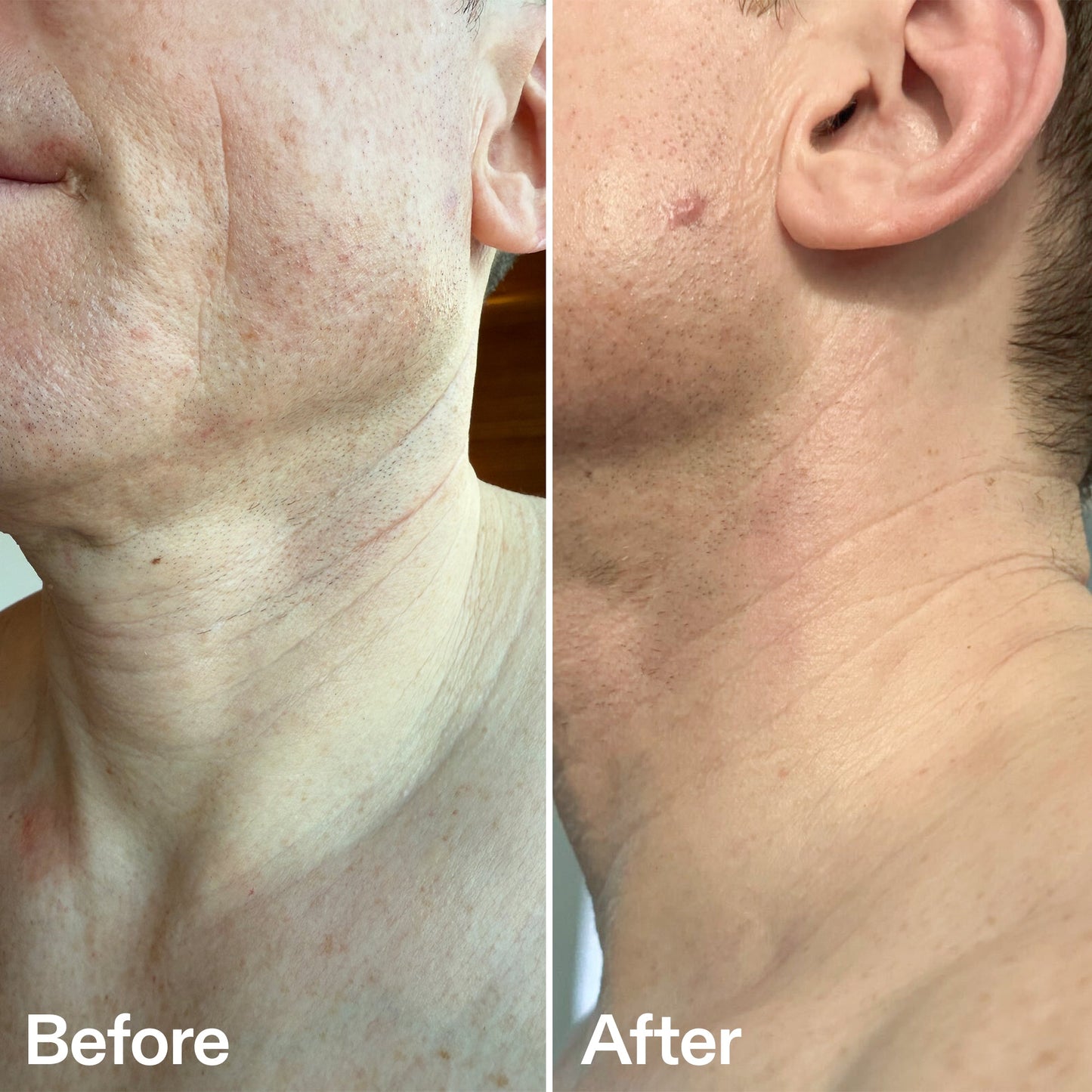 bio-active-neck-lift-stick-g7 B_A_afa2743e-b8e2-4504-92f4-e281cb6cf759.jpg