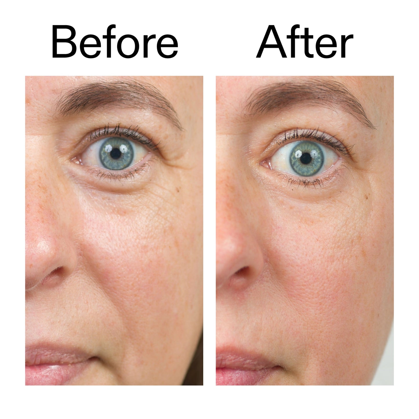 bio-active-ceramide-moisturizer-duo-l2 Bio-Active_Before_After_2000x2000_566e5a9e-135e-417a-8242-b44e5fa35463.jpg