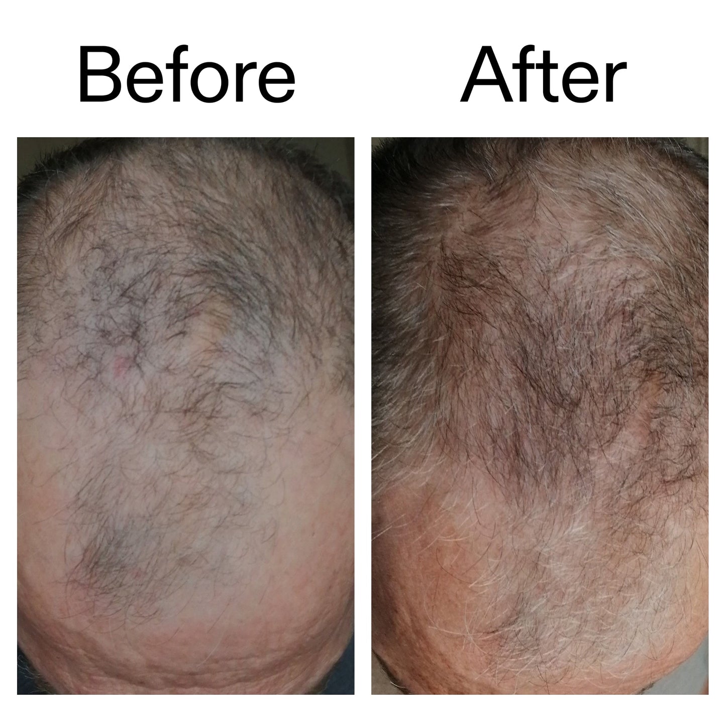 caffeine-stimulating-scalp-treatment-p5 Caffeine_Scalp_Treatment_B_A_Ppage_2000_x_2000.jpg