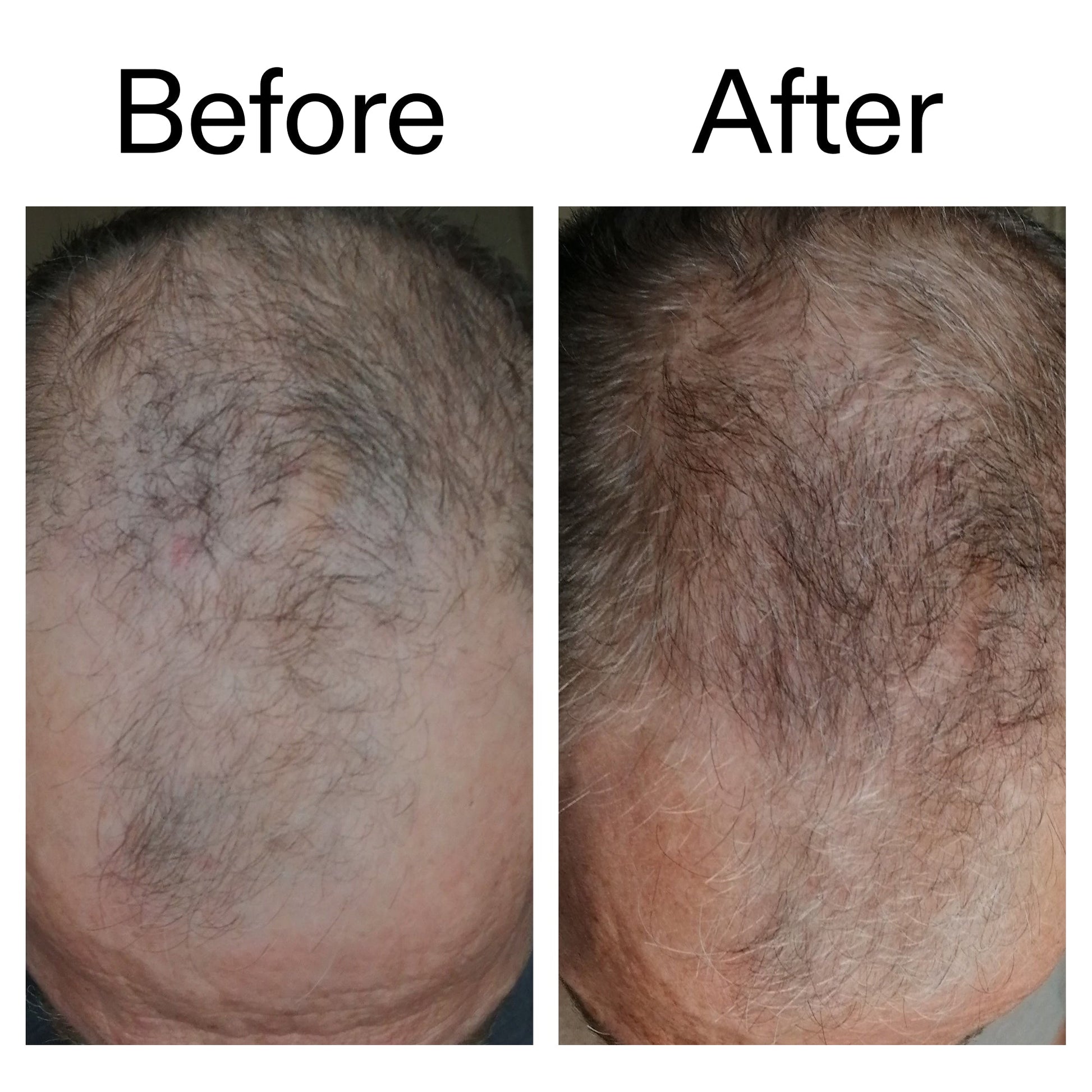 3-month-hair-growth-trio-q5 Caffeine_Scalp_Treatment_B_A_Ppage_2000_x_2000.jpg