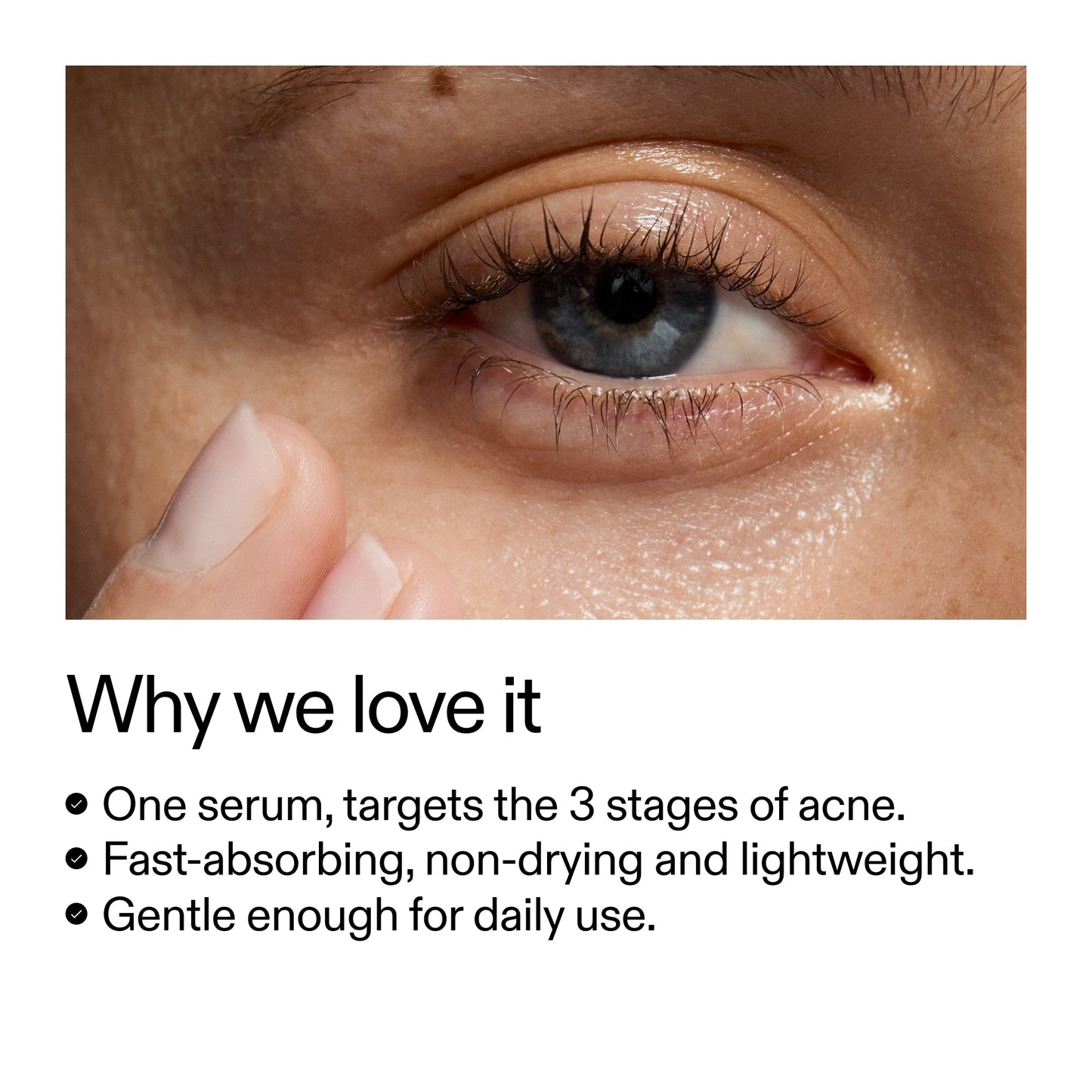 360-acne-clearing-duo-o2 Dioic_Whyweloveit_2000x2000_175aafd3-0cbe-403a-b317-a8362881bfe2.jpg