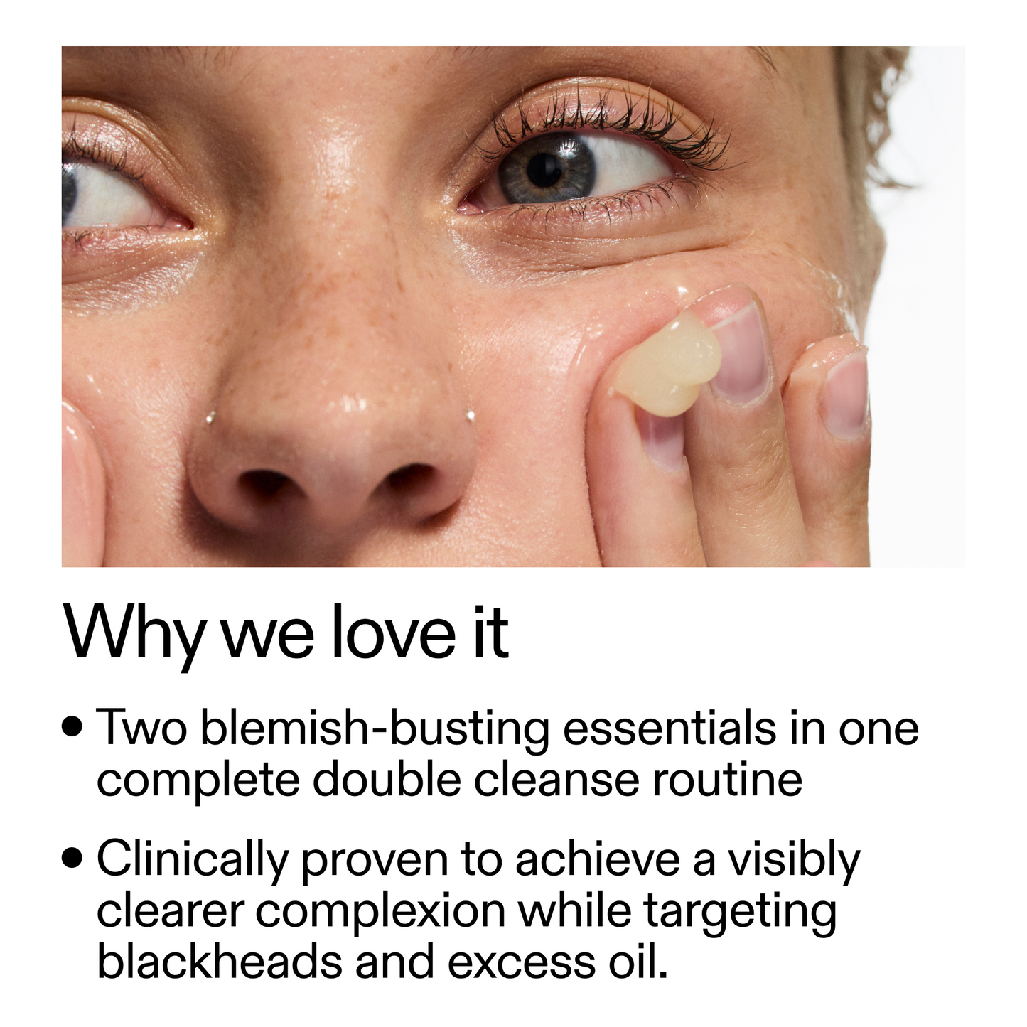 acne-double-cleanse-duo-r7 Double_Cleanse_Duo_for_Breakouts_Why_We_2000x2000_f242cb12-bb5c-487c-b203-071ccb406ec5.png