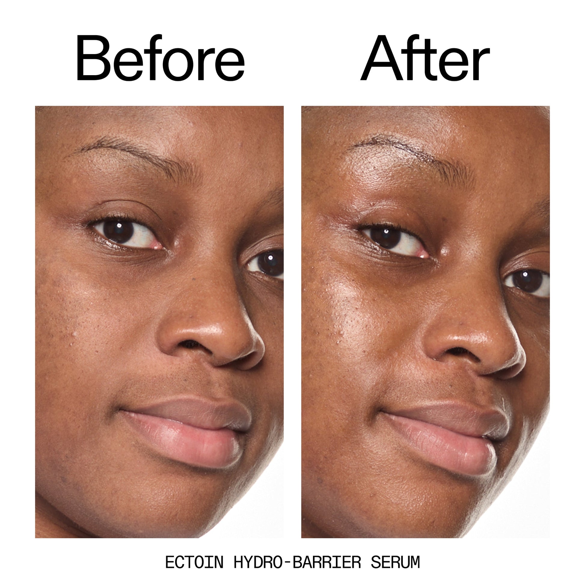 barrier-boosting-trio-t2 Ectoin_Before_After_2000x2000_ce35bc41-4da0-4b6f-adc7-29f8641f6c6c.jpg