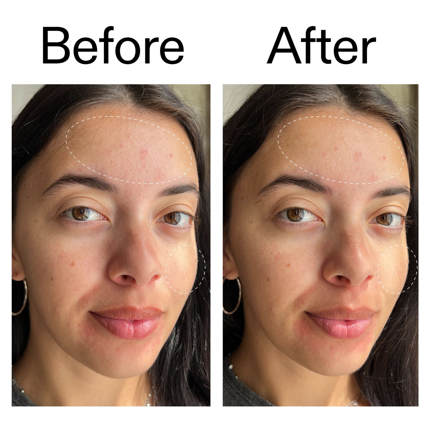 glycerin-gentle-purifying-cleanser-b6 Glycerin_B_A_2000x2000_19037705-c220-4333-99c1-e648cc3ac1d7.jpg