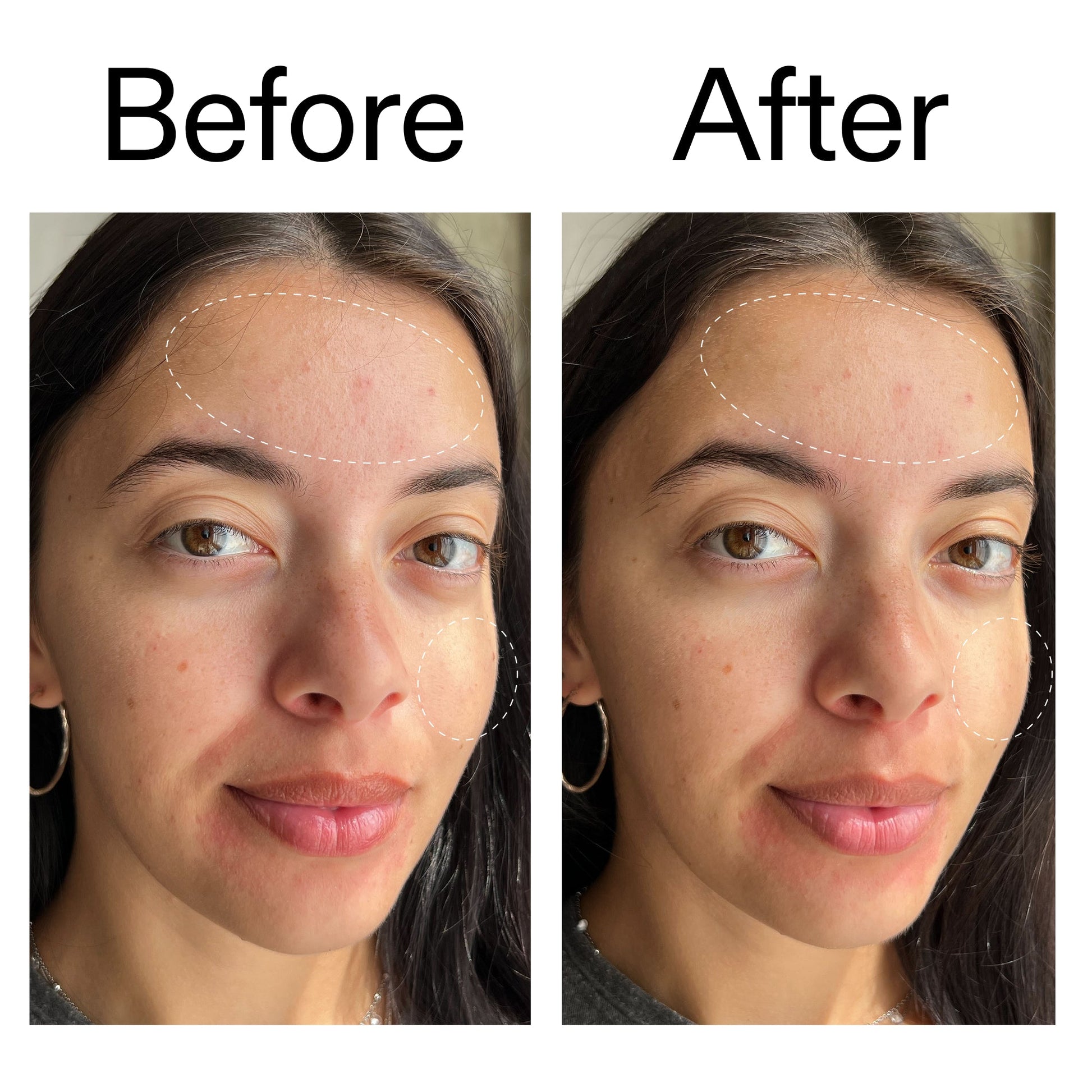 glycerin-gentle-purifying-cleanser-b6 Glycerin_B_A_2000x2000_19037705-c220-4333-99c1-e648cc3ac1d7.jpg