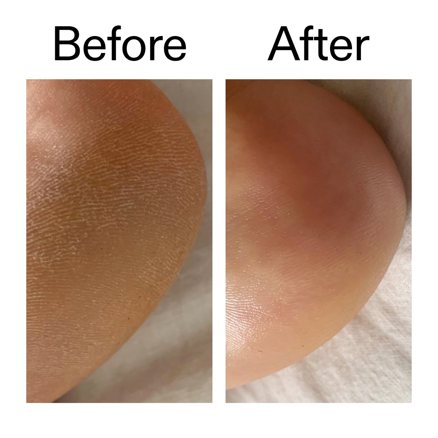 glycolic-acid-exfoliating-body-stick-duo-t8 Glycolic_Acid_Exfoliating_Body_Stick_Before_After_V1_2000x2000_a3043625-9400-429a-a7fb-d6dbd220f722.jpg