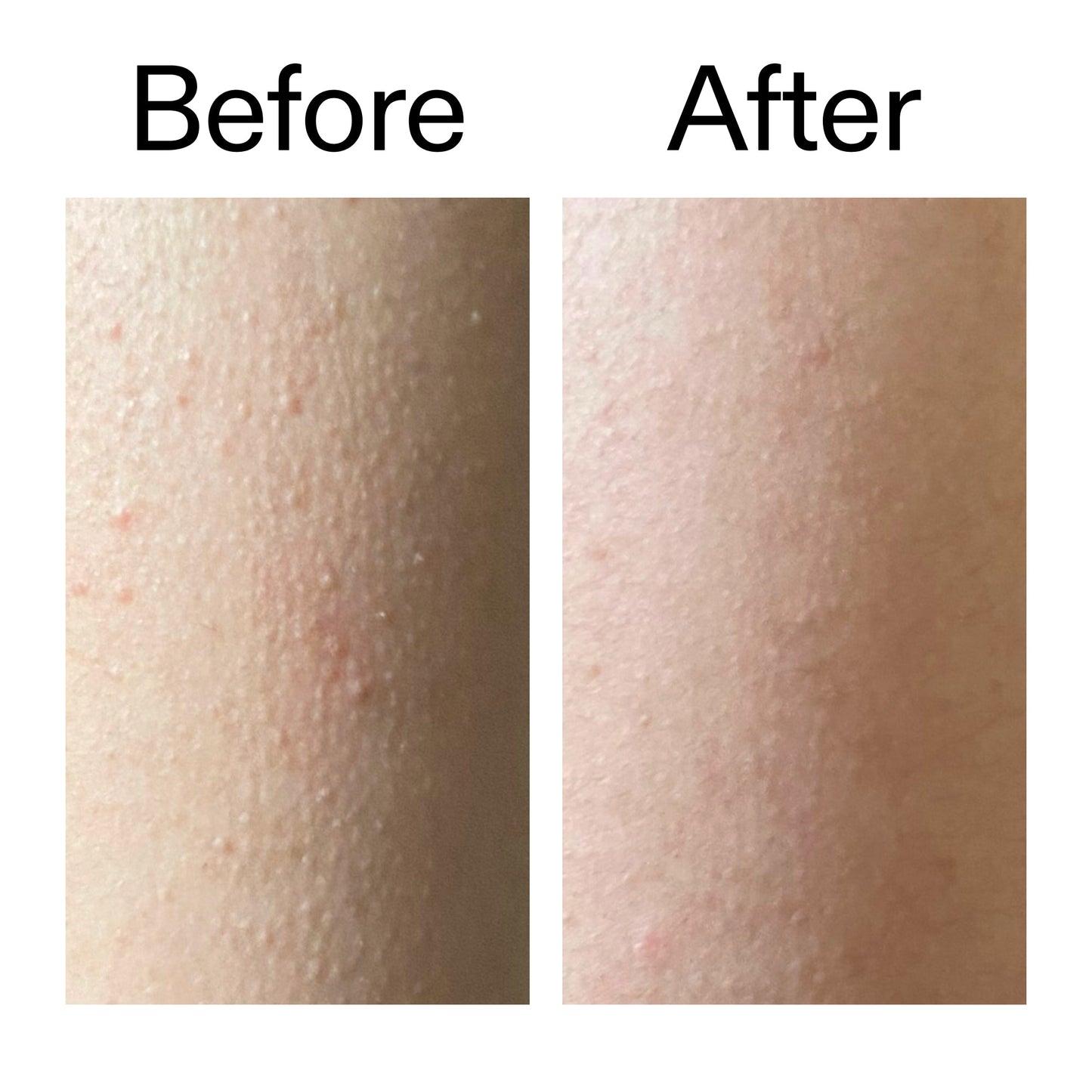 glycolic-acid-exfoliating-body-stick-duo-t8 Glycolic_Acid_Exfoliating_Body_Stick_Before_After_V2_2000x2000_2e4ba052-94f6-4d56-82df-7bdb5b2df7ae.jpg