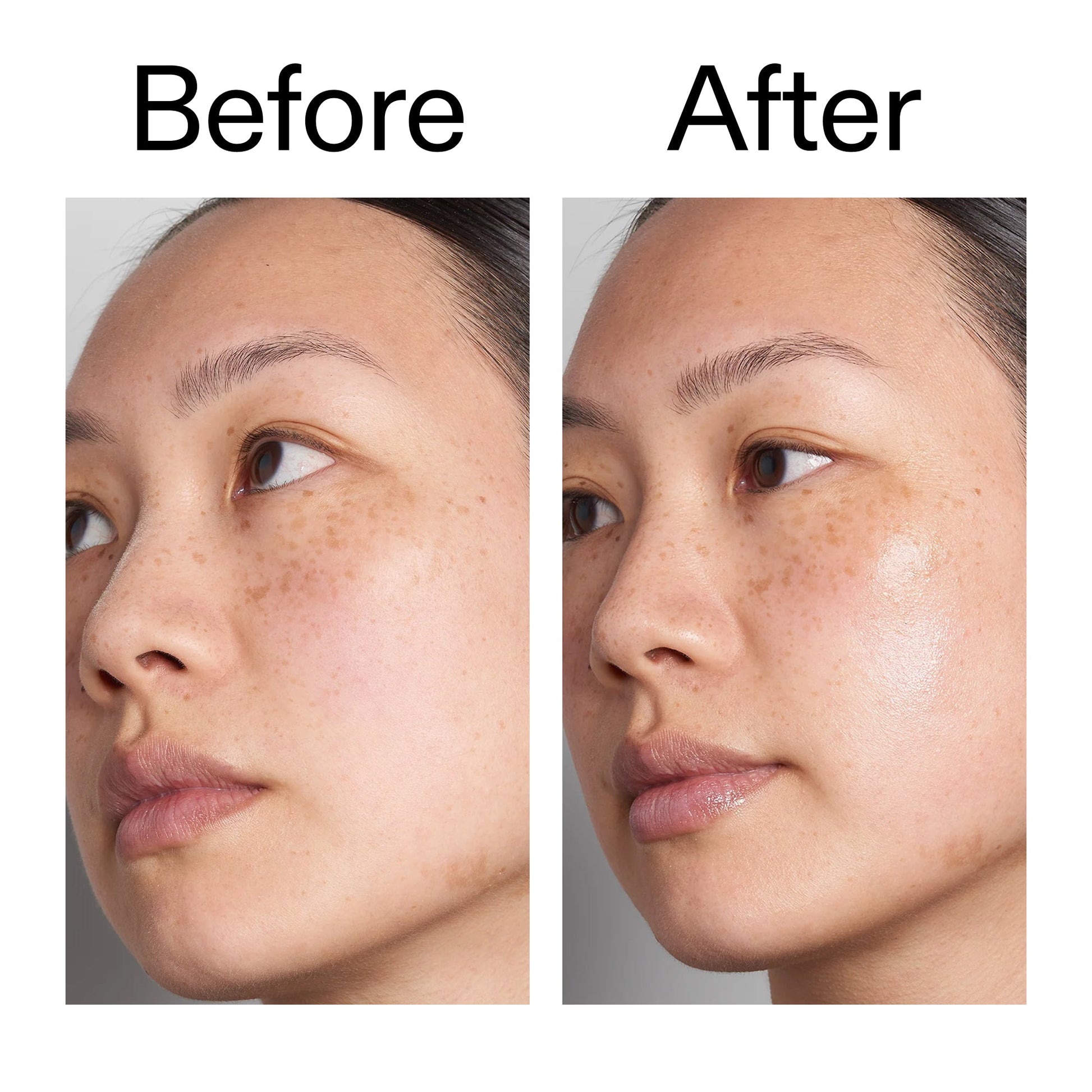 hyaluronic-acid-serum-30ml-j0 Hyaluronic_Acid_Before_After_2000x2000_d7983956-8aa2-4ea3-8255-c63e8d4f892e.jpg