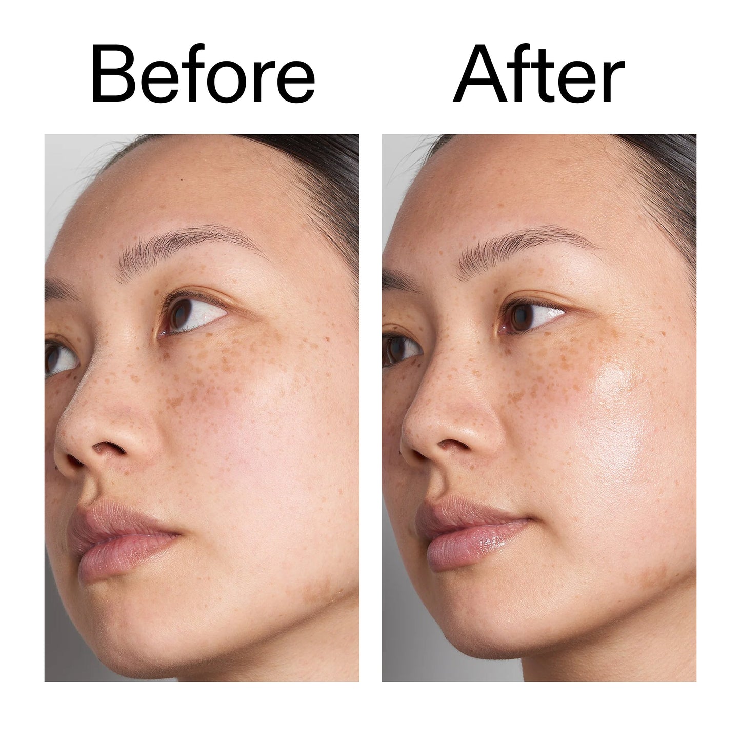 supersize-hyaluronic-acid-serum-100ml-duo-d0 Hyaluronic_Acid_Before_After_2000x2000_d7983956-8aa2-4ea3-8255-c63e8d4f892e.jpg