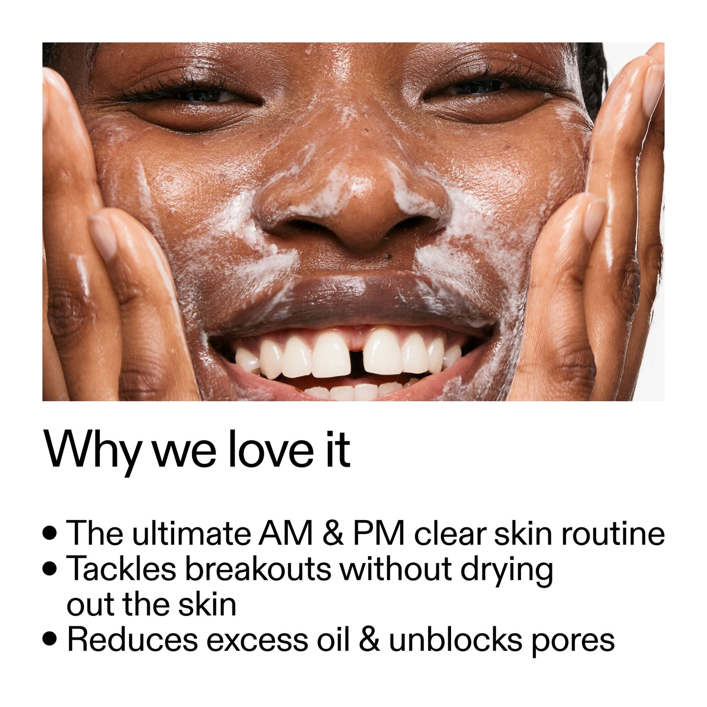 intro-routine-for-acne-b4 Intro_Routine_for_Acne_Why_we_love_it_2000x2000_42499e10-4629-4a0e-a627-7e215f4da6bc.jpg