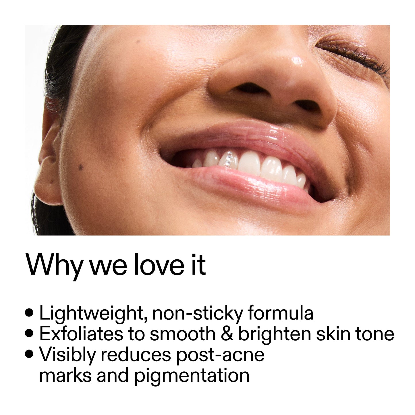 mandelic-acid-treatment-d9 Mandelic_Acid_Treatment_Why_we_love_it_2000x2000_6dfe29a9-2a79-464f-a5e8-e5ac37d93388.jpg