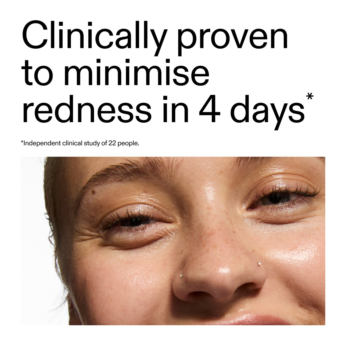 10-azelaic-acid-serum-for-redness-relief-o4 Oat_Cleansing_Balm_Claim_2000x2000_52a841dc-353c-4f2c-8646-3aadb604507d.jpg