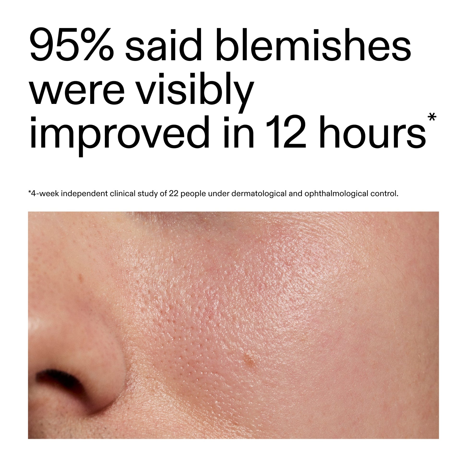 succinic-acid-acne-treatment-p6 Oat_Cleansing_Balm_Claim_2000x2000_ac6ce553-25db-41b2-a981-faae1ac4b8c0.jpg