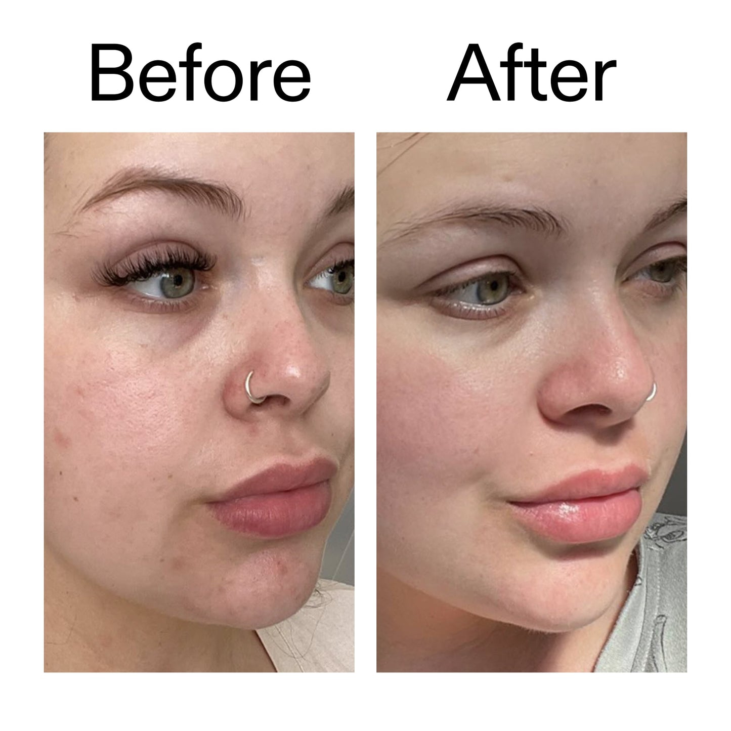 supersize-omega-water-cream-duo-n1 Omega50_Before_After_2000x2000_46483ed8-3f9d-487f-9a0c-9df79830bd65.jpg
