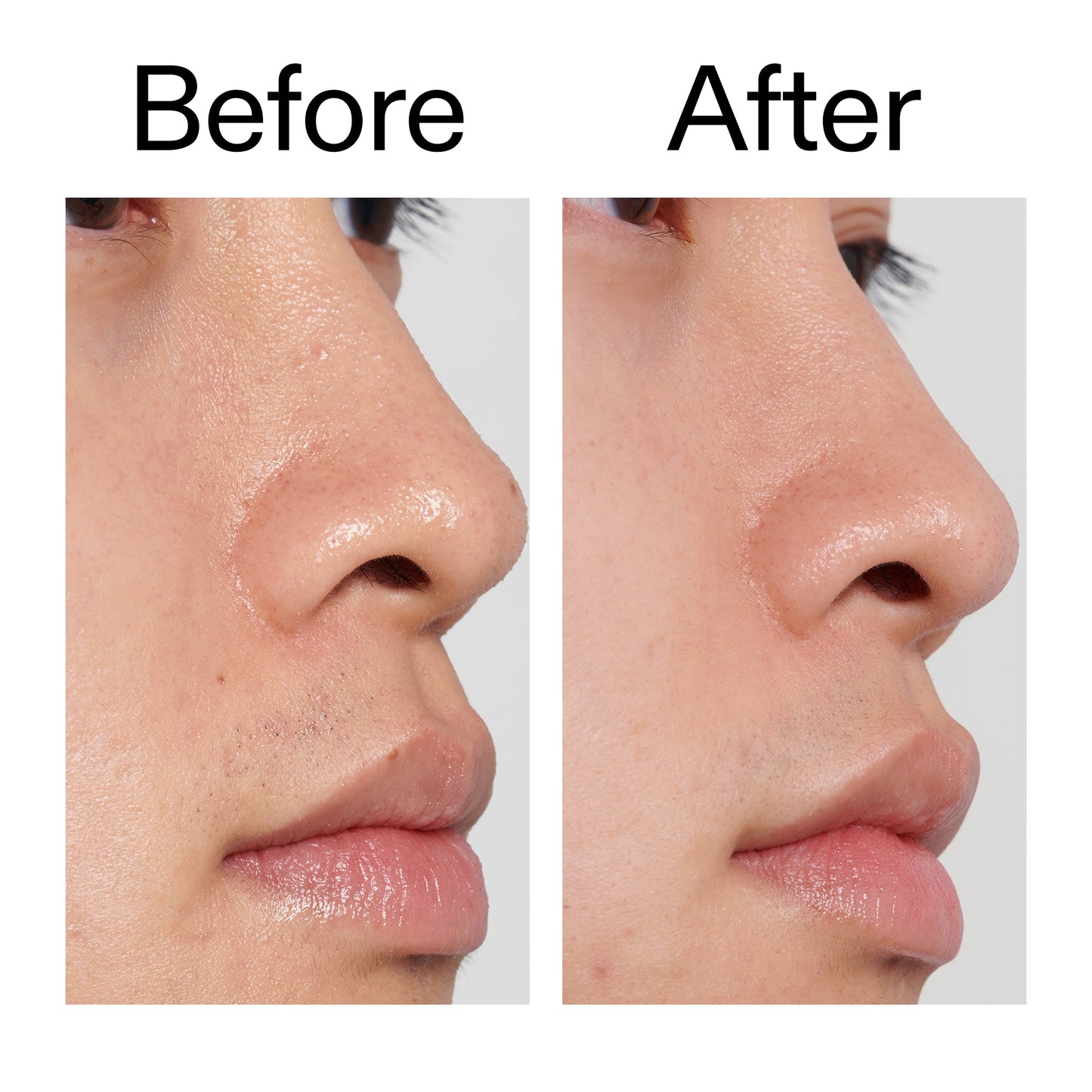 pha-toner-m9 PHA_Toner_Before_After_2000x2000_e3c10172-0150-4342-8b95-57417eaff50d.jpg
