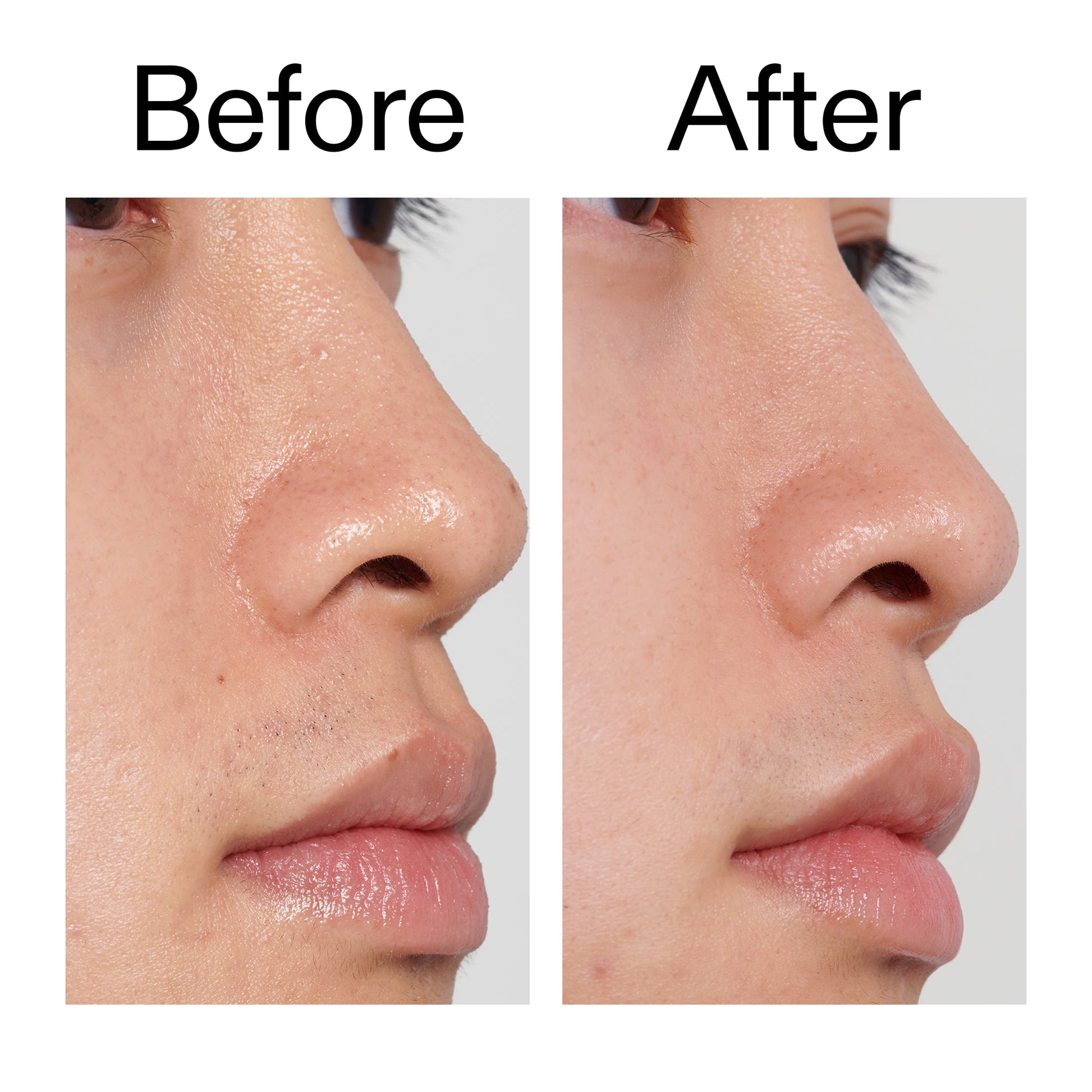 pha-toner-m9 PHA_Toner_Before_After_2000x2000_e3c10172-0150-4342-8b95-57417eaff50d.jpg