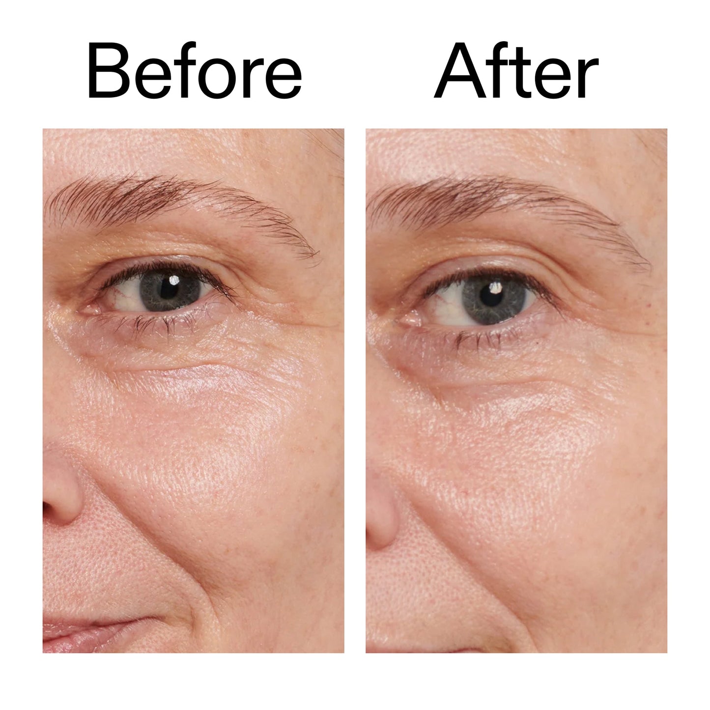 retinol-eye-cream-o8 Retinol_Eye_Cream_Before_After_2000x2000_ac03a80c-109e-4572-a95a-91dc109b4d27.jpg