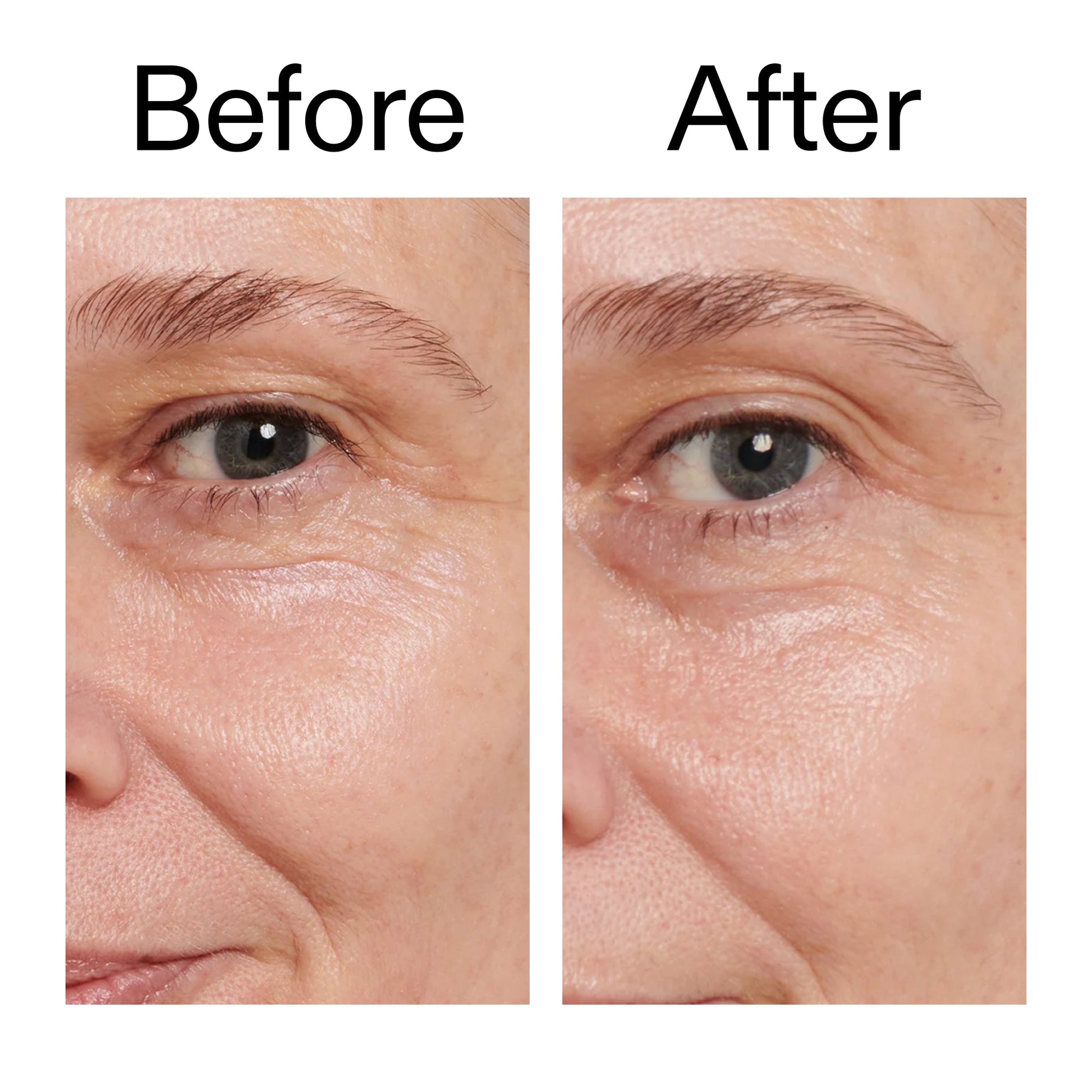 retinol-eye-cream-o8 Retinol_Eye_Cream_Before_After_2000x2000_ac03a80c-109e-4572-a95a-91dc109b4d27.jpg