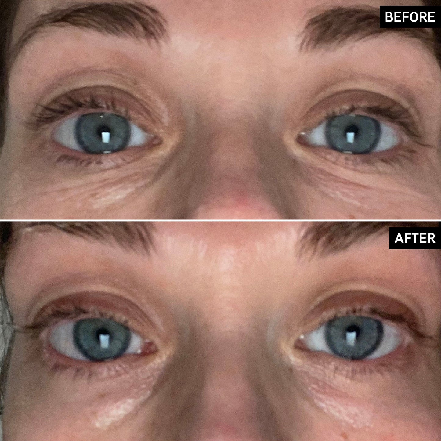 retinol-eye-cream-o8 SITE-UGCBAsApril_Nicole_B_A_PPage_2000x2000_1.jpg