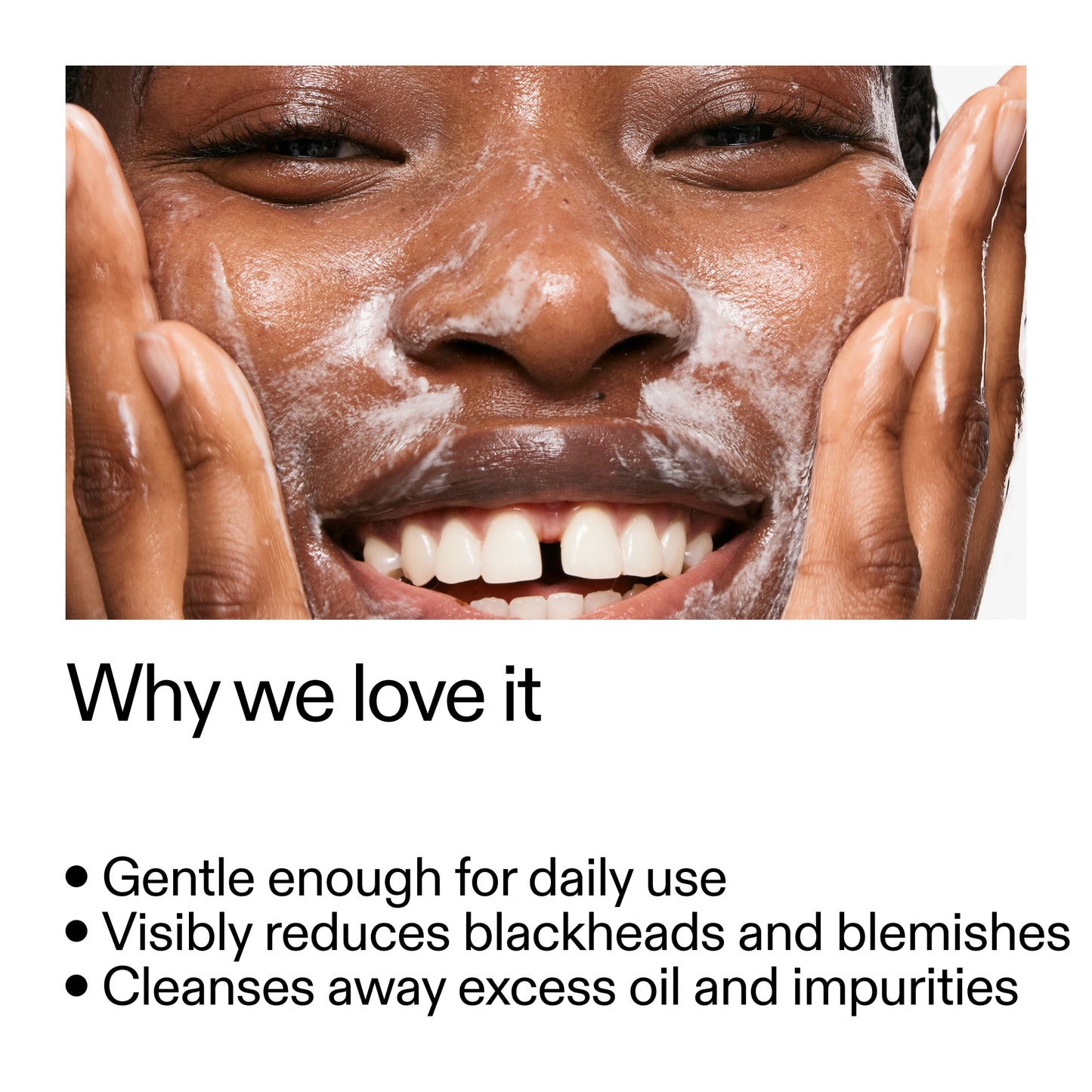 salicylic-acid-cleanser-duo-s9 Salicylic_Acid_Cleanser_-_300mlWhy_we_love_it_2000x2000_87dc92a9-2559-4309-98cd-4e570f1be735.jpg