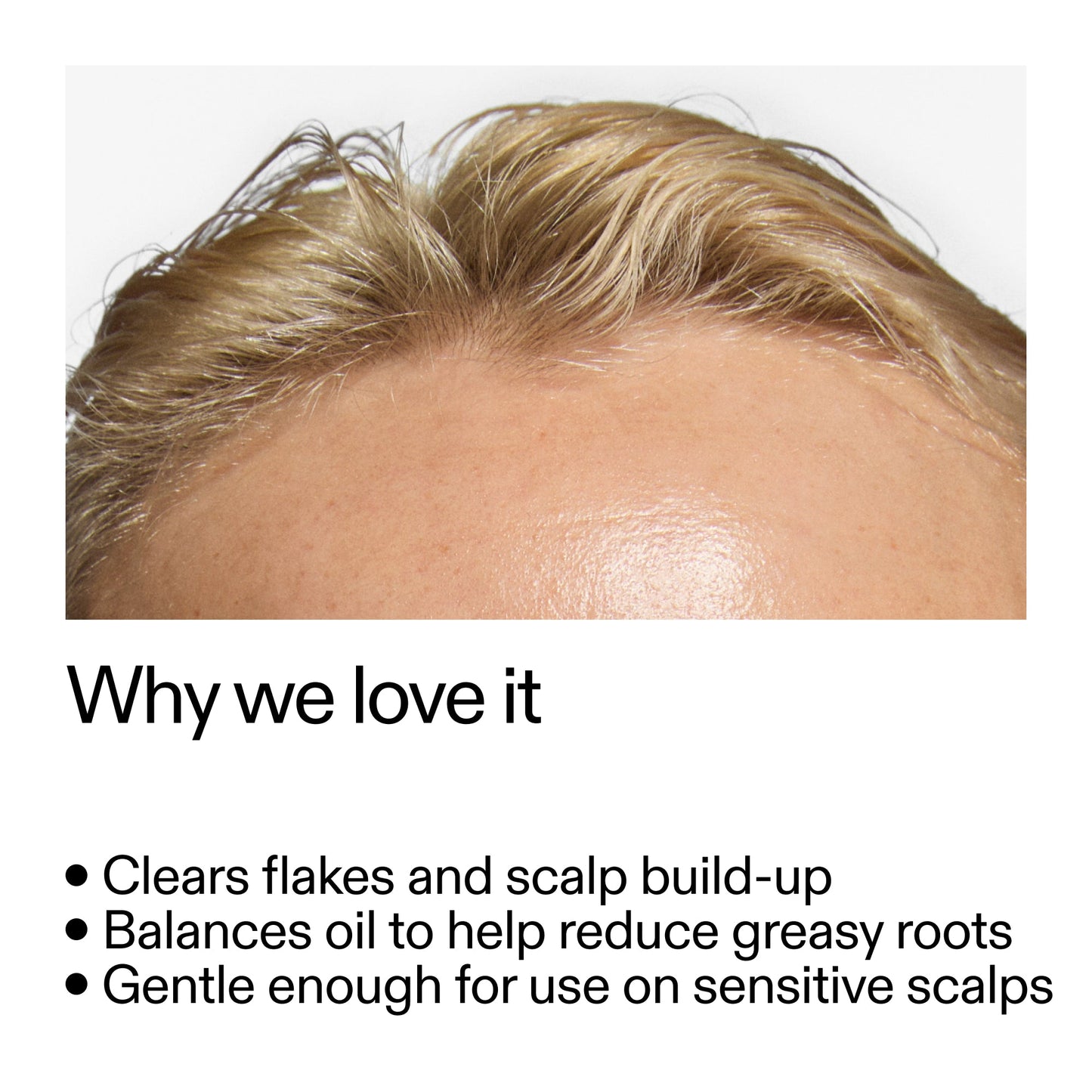 salicylic-acid-exfoliating-scalp-treatment-o7 Salicylic_Acid_Exfoliating_Scalp_Treatment_Why_we_love_it_2000x2000_44b6bd6d-9ec4-4b23-9dc4-bc3fd6f28e14.jpg