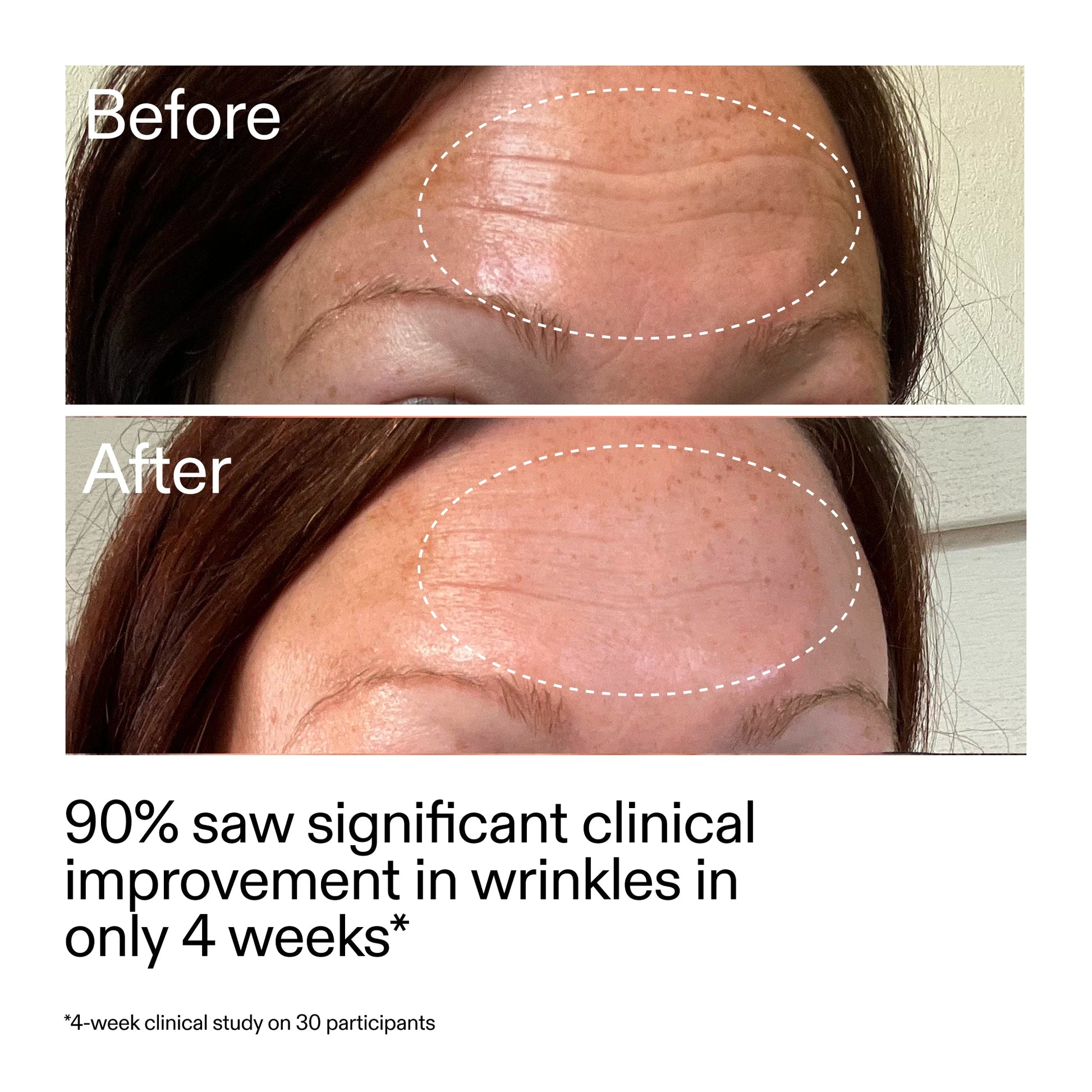 starter-retinol-serum-duo-t8 StarterRetinol_BeforeAfter_Claim1_2000x2000_03b4d6e5-a357-43b9-a855-aba5e35c57f3.jpg