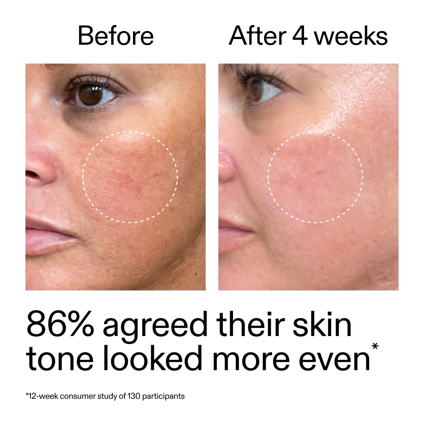 starter-retinol-serum-l1 StarterRetinol_BeforeAfter_Claim2_2000x2000_f5c9ecc0-8d76-429d-bef5-c3a61bcf5c09.jpg