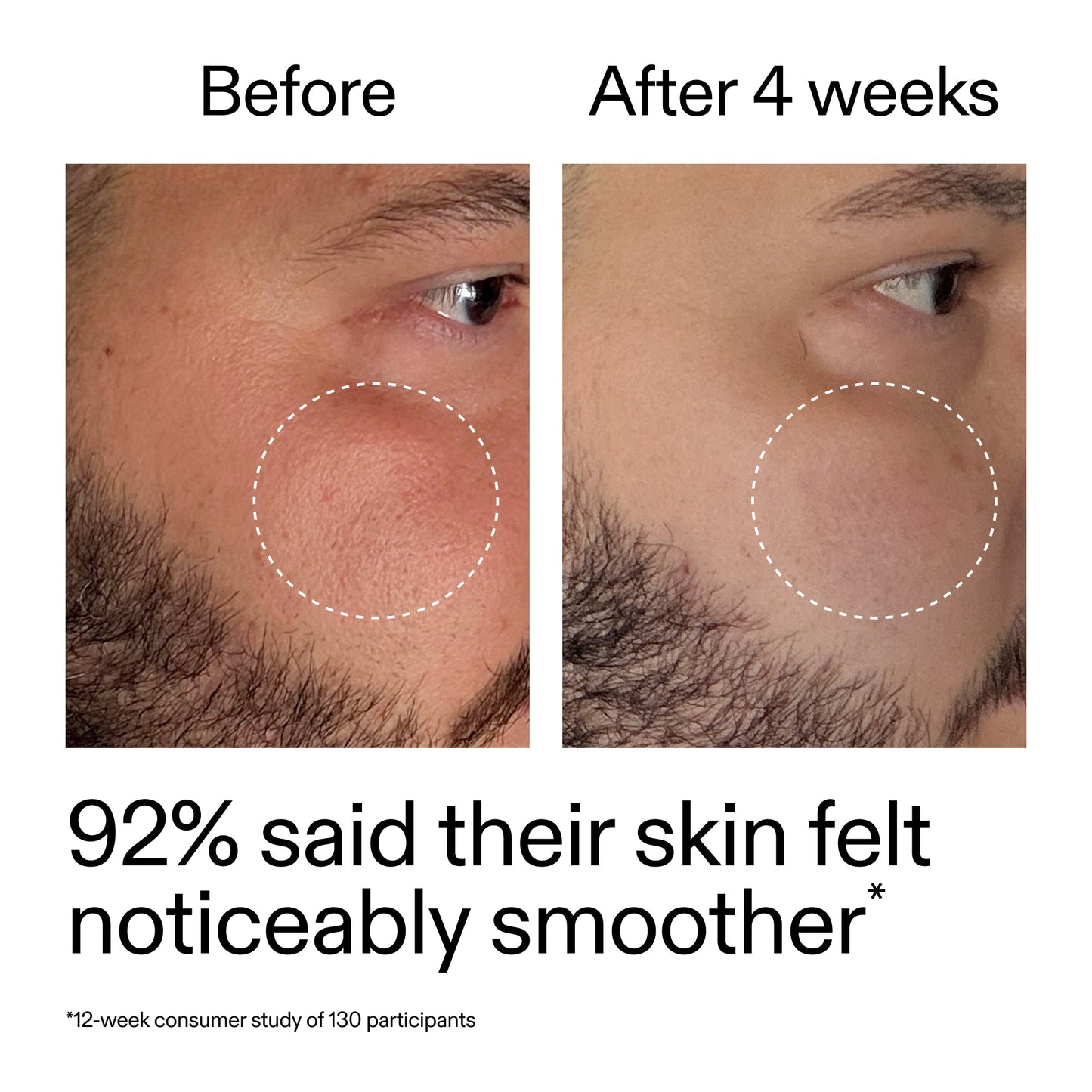 starter-retinol-serum-l1 StarterRetinol_BeforeAfter_Claim3_2000x2000_6ceab106-e0ee-4ed4-ba62-41bc39538038.jpg