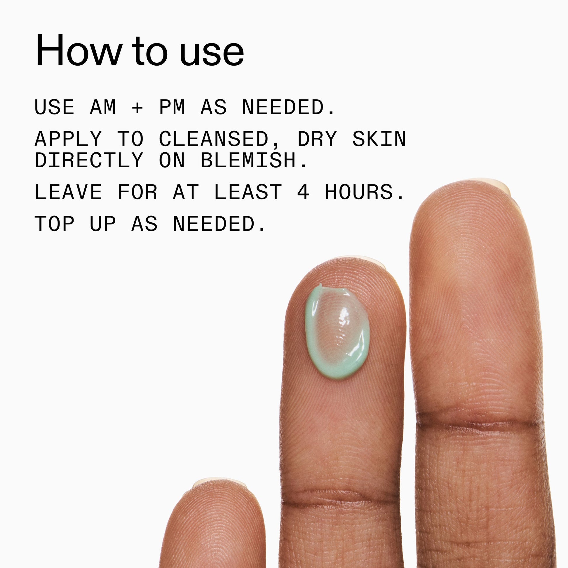 succinic-acid-acne-treatment-p6 Succinic_Acid_Treatment_How_to_Use_2000x2000_d57137d5-d7f1-427c-9a46-5fc00c19c542.jpg