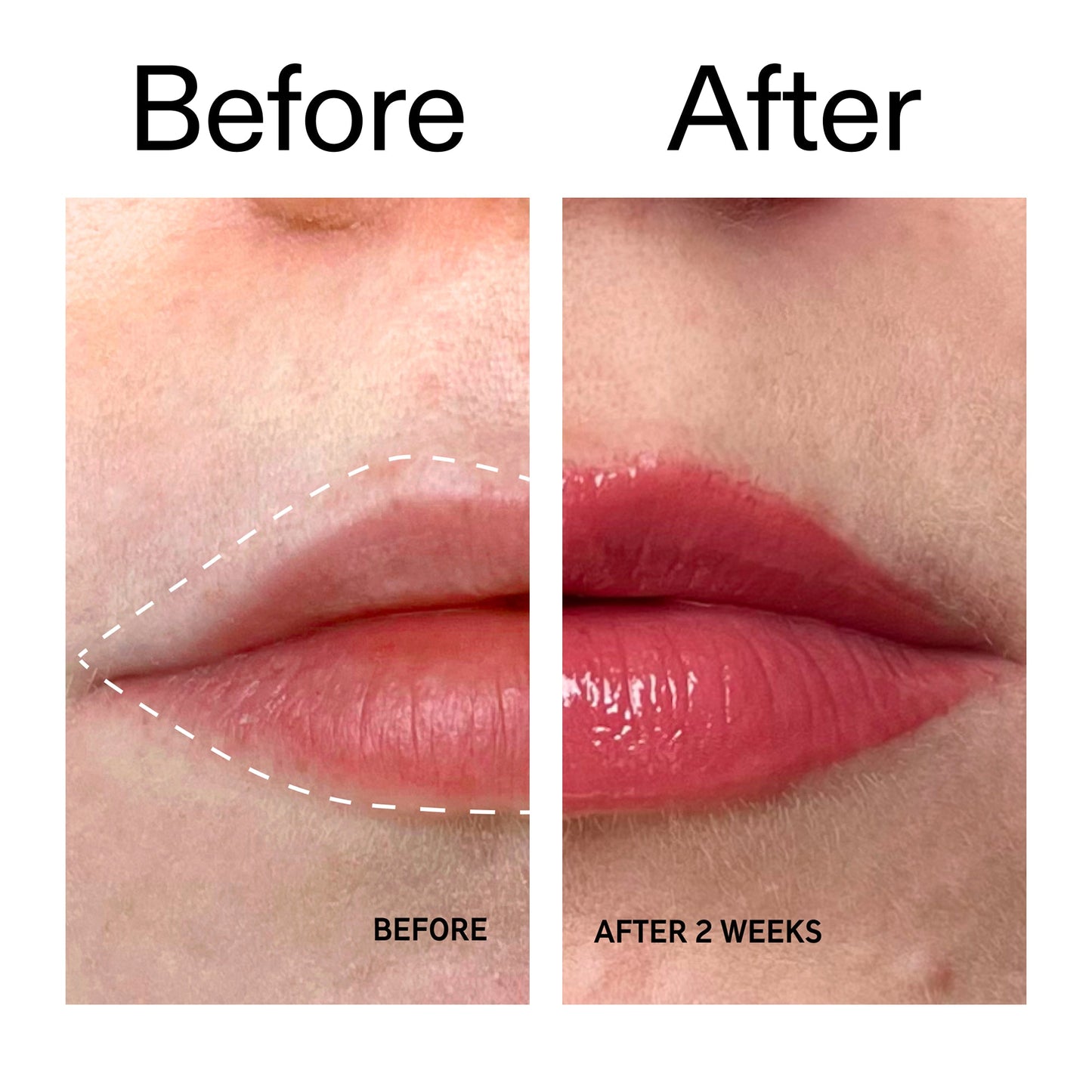 tripeptide-plumping-berry-lip-balm-o5 Tripeptide_Plumping_Lip_Balm_-_Berry_Before_After_2000x2000_9474bbd8-43ca-4b0e-b0e7-dfab70b91927.jpg