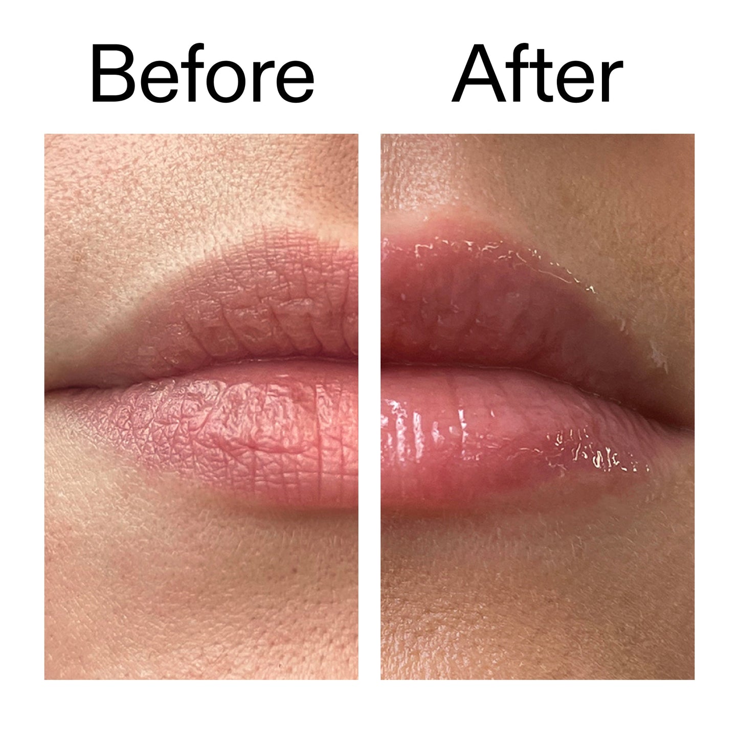 tripeptide-plumping-lip-balm-l4 Tripeptide_Plumping_Lip_Balm_Before_After_2000x2000_b4a5ee04-d2ac-4857-8f01-17209acc4bf3.jpg