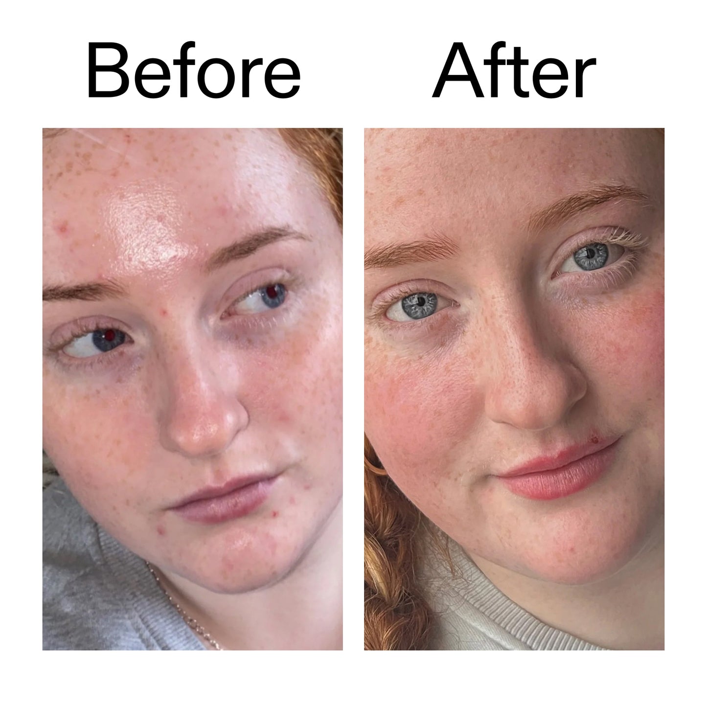 vitamin-b-c-and-e-moisturizer-q5 Vitamin_B_C_and_E_Moisturizer_Before_After_2000x2000_b0781a76-5ad2-4be9-95b8-ef92b356833c.jpg